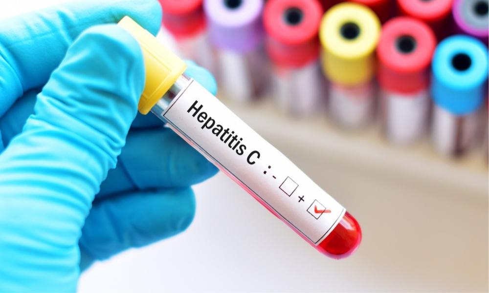 hepatitis c