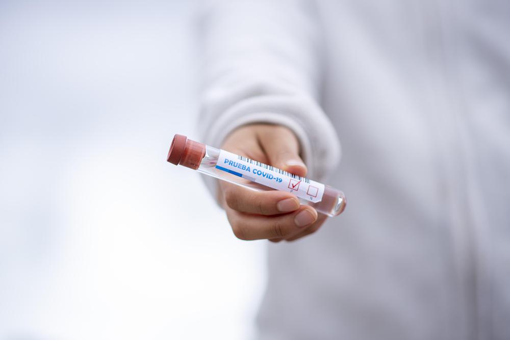 test-tube-5065426