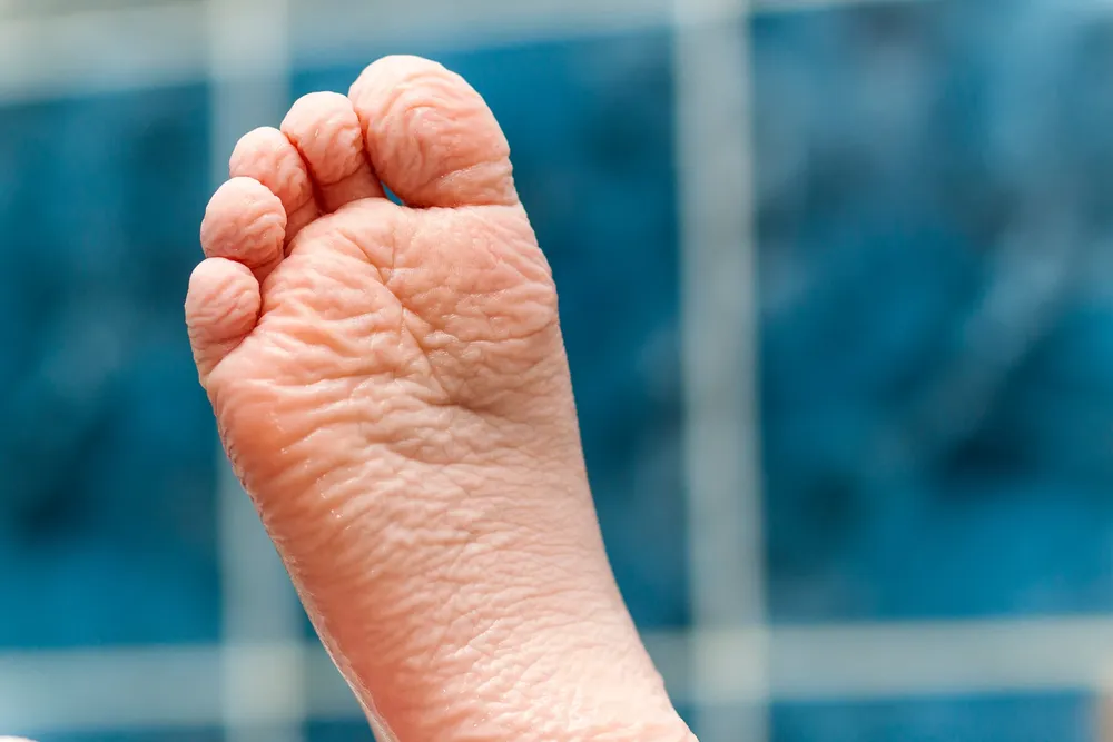 pie arrugado por el agua