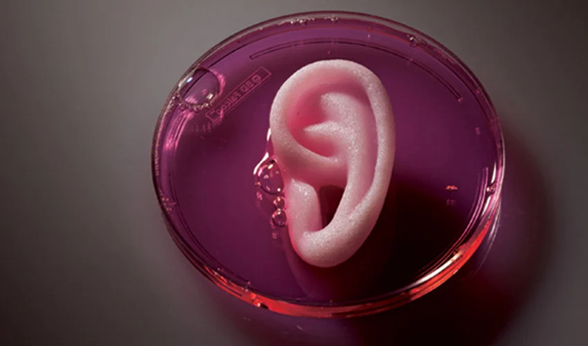 oreja