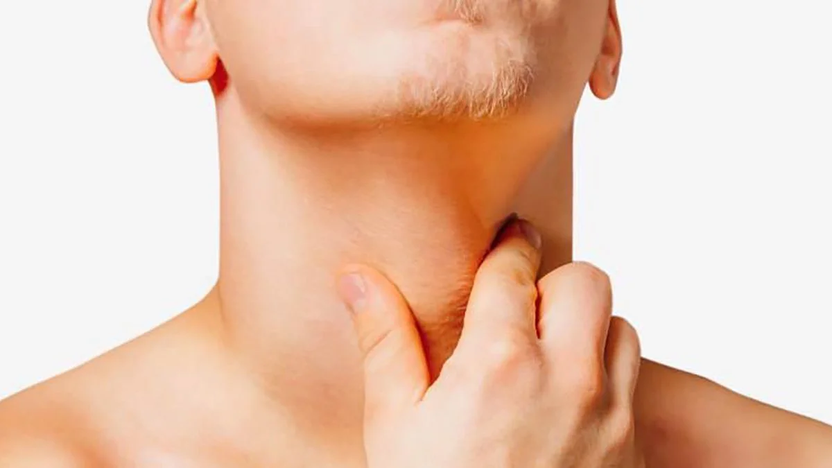 linfoma
