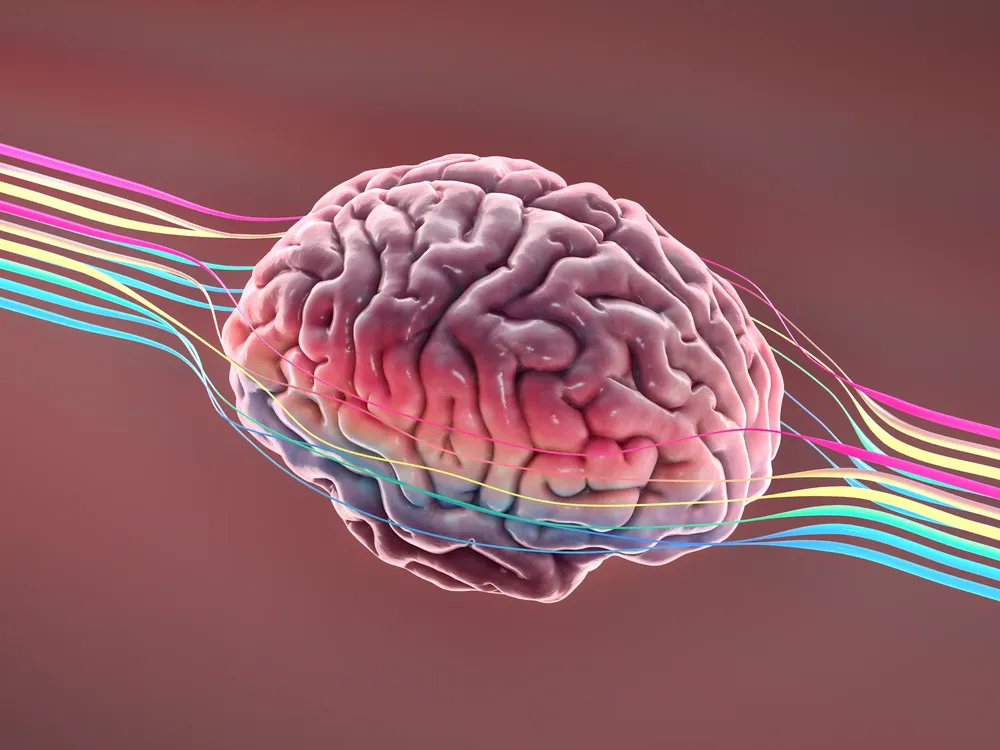 alzheimer