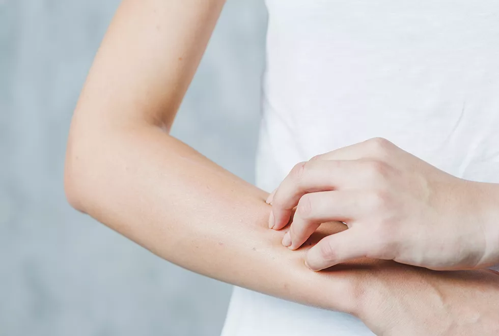 diferencias_psoriasis_dermatitis_atopica