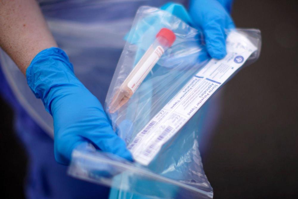 hisopado coronavirus