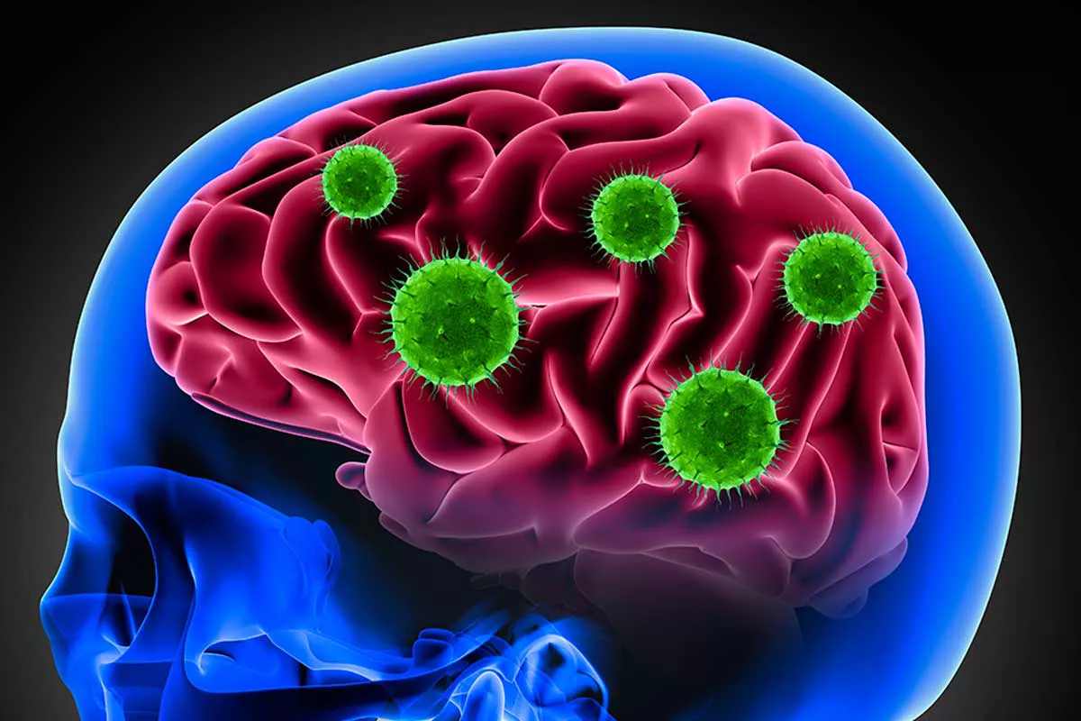 virus cerebro covid