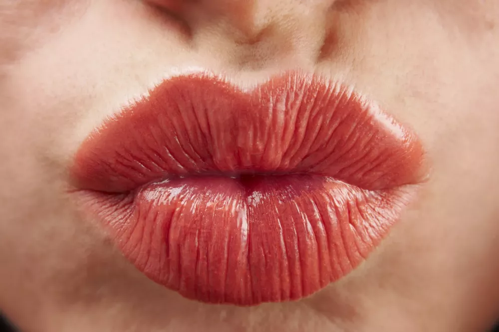 besos