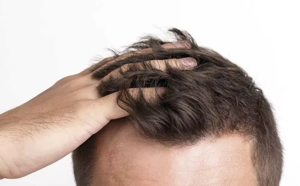 pelo
